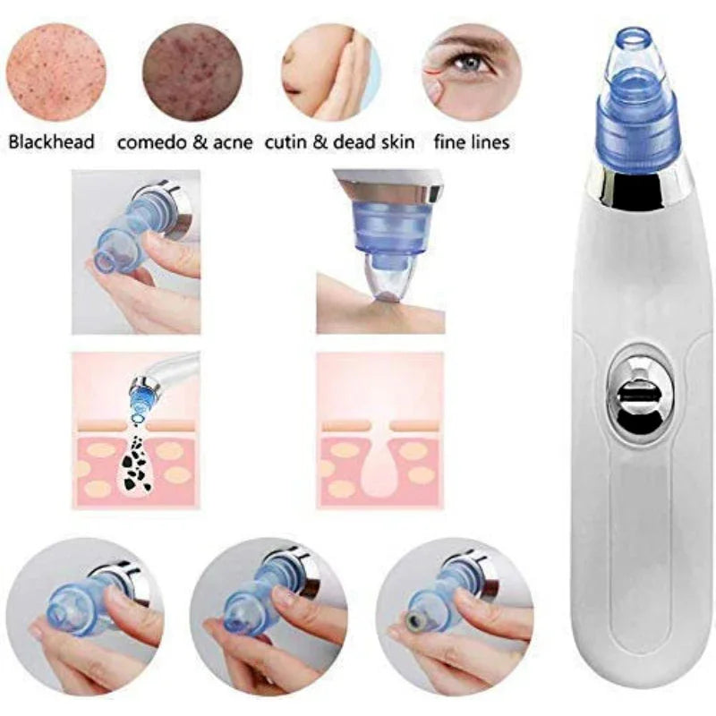 DermaSuction Multifunctional Cleaning Instrument For Pimple Removal Blackhead Remover