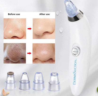 DermaSuction Multifunctional Cleaning Instrument For Pimple Removal Blackhead Remover